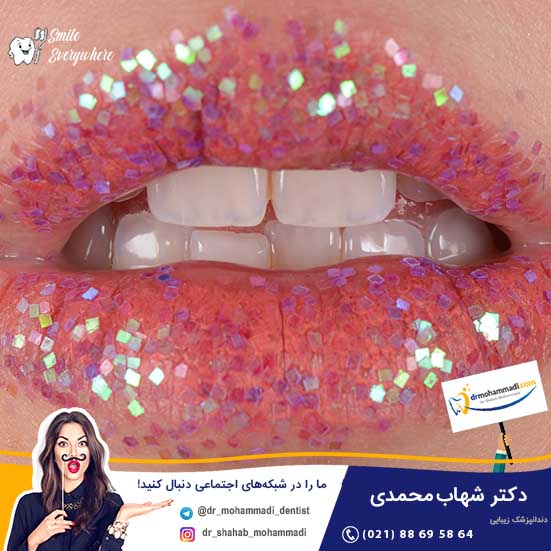 بلیچینگ دندان یا کامپوزیت؟ کدام روش بهتر است؟ - کلینیک دندانپزشکی دکتر شهاب محمدی